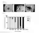 Fig. 04 - PROCESS FOR PRODUCTION OF BIOARTIFICIAL ORGAN