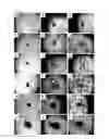 Fig. 05 - PROCESS FOR PRODUCTION OF BIOARTIFICIAL ORGAN