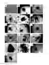 Fig. 06 - PROCESS FOR PRODUCTION OF BIOARTIFICIAL ORGAN