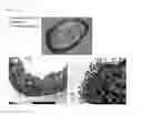 Fig. 11 - PROCESS FOR PRODUCTION OF BIOARTIFICIAL ORGAN