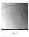 Fig. 10 - Method for making nerve graft