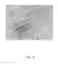 Fig. 08 - Method for making nerve graft