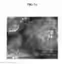 Fig. 08 - Method for manufacturing solar cell including etching