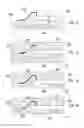 Fig. 07 - Pre-bonded substrate for integrated circuit package and method of making the same