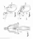 Fig. 02 - Connector assemblies and contacts for implantable medical electrical systems