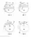Fig. 05 - Method of deburring a ball