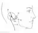 Fig. 01 - Control system and apparatus utilizing signals originating in the periauricular neuromuscular system