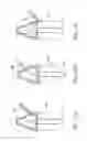 Fig. 17 - Differential mechanism having multiple case portions