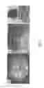 Fig. 02 - METHOD FOR DETECTING NUCLEATED CELLS