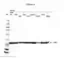 Fig. 07 - Modified leptin polypeptides and their uses