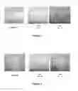 Fig. 04 - Peptides and uses thereof to modulate IGF-1 synthesis and IGF-1 receptor expression