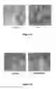 Fig. 05 - Peptides and uses thereof to modulate IGF-1 synthesis and IGF-1 receptor expression