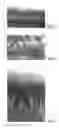 Fig. 02 - Methods and compositions for regenerating articular cartilage