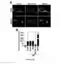 Fig. 14 - COMPOSITIONS AND MODULATION OF MYOCYTE ENHANCER FACTOR 2 (MEF2)