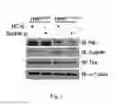 Fig. 05 - Methods for modulating the expression and aggregation of CAG-expanded gene product in cells and methods for identifying agents useful for doing the same