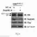 Fig. 06 - Methods for modulating the expression and aggregation of CAG-expanded gene product in cells and methods for identifying agents useful for doing the same