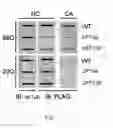 Fig. 09 - Methods for modulating the expression and aggregation of CAG-expanded gene product in cells and methods for identifying agents useful for doing the same