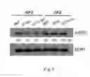 Fig. 10 - Methods for modulating the expression and aggregation of CAG-expanded gene product in cells and methods for identifying agents useful for doing the same