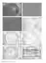 Fig. 01 - Pharmaceutical composition for preventing, stabilising and/or inhibiting blood and lymph vascularization