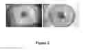 Fig. 03 - Pharmaceutical composition for preventing, stabilising and/or inhibiting blood and lymph vascularization