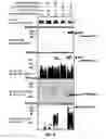 Fig. 16 - Gene and Protein Relating to Hepatocellular Carcinoma and Methods of Use Thereof