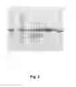 Fig. 03 - Method for purifying albumin