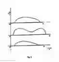 Fig. 08 - Radiation Therapy Delivery System and Radiation Therapy Treatment Planning