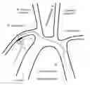 Fig. 01 - Intra-aortic balloon pump assembly for ventricular assist device