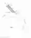 Fig. 02 - Intra-aortic balloon pump assembly for ventricular assist device