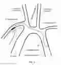Fig. 03 - Intra-aortic balloon pump assembly for ventricular assist device