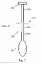 Fig. 06 - Intra-aortic balloon pump assembly for ventricular assist device