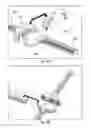 Fig. 08 - Intra-aortic balloon pump assembly for ventricular assist device