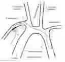 Fig. 01 - Ventricular assist device