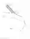Fig. 02 - Ventricular assist device