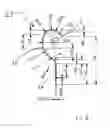 Fig. 03 - Implantable devices for the treatment of incontinence and methods of using same