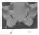 Fig. 06 - Implantable devices for the treatment of incontinence and methods of using same