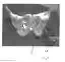 Fig. 10 - Implantable devices for the treatment of incontinence and methods of using same