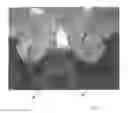 Fig. 12 - Implantable devices for the treatment of incontinence and methods of using same
