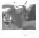 Fig. 13 - Implantable devices for the treatment of incontinence and methods of using same