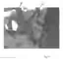 Fig. 14 - Implantable devices for the treatment of incontinence and methods of using same