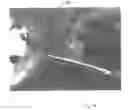 Fig. 16 - Implantable devices for the treatment of incontinence and methods of using same