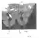Fig. 19 - Implantable devices for the treatment of incontinence and methods of using same