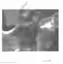 Fig. 26 - Implantable devices for the treatment of incontinence and methods of using same