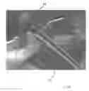 Fig. 28 - Implantable devices for the treatment of incontinence and methods of using same