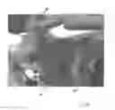 Fig. 29 - Implantable devices for the treatment of incontinence and methods of using same