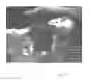 Fig. 31 - Implantable devices for the treatment of incontinence and methods of using same