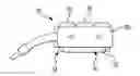 Fig. 01 - LAPAROSCOPIC ADJUSTABLE GASTRIC BAND