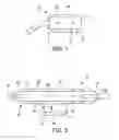 Fig. 02 - LAPAROSCOPIC ADJUSTABLE GASTRIC BAND