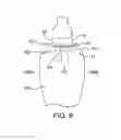 Fig. 06 - LAPAROSCOPIC ADJUSTABLE GASTRIC BAND