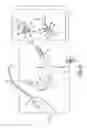 Fig. 04 - Surgical articles and methods